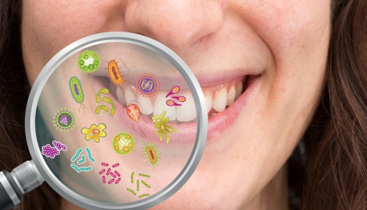 Magnifying glass showing possible set of bacteria the oral cavity causing caries, plaque, tartar, gingivitis, pyorrhea and halitosis
