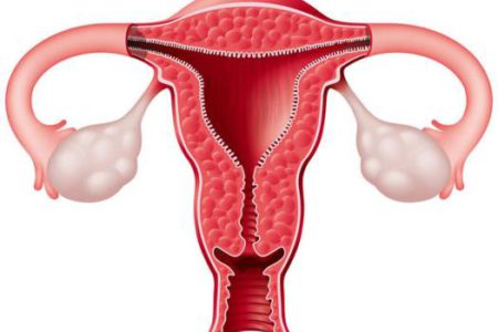 endometrium rák ultrahang