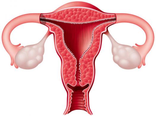 endometrium, mióma